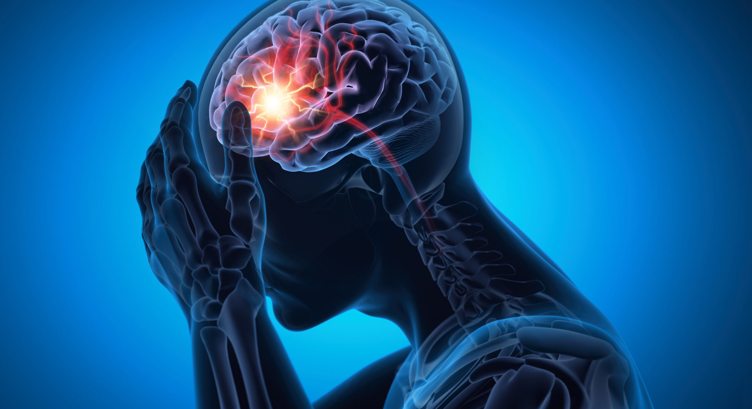 Man with a strong headache - Brain Stroke - Medical X Ray 3D Illustration with blue background