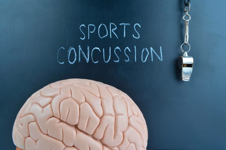 Chalkboard with 'Sports Concussion' written in chalk, plastic brain model, and hanging whistle symbolizing brain injury awareness and athlete safety.